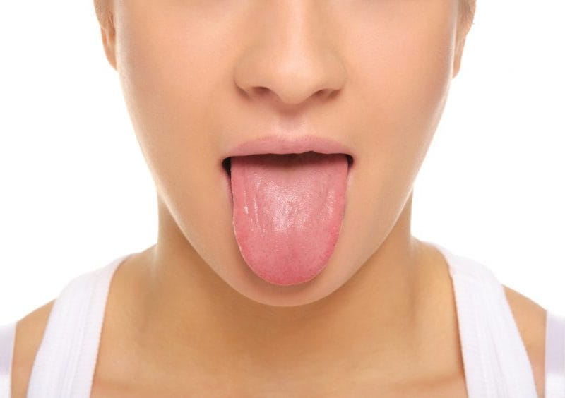 Picture of Tongue