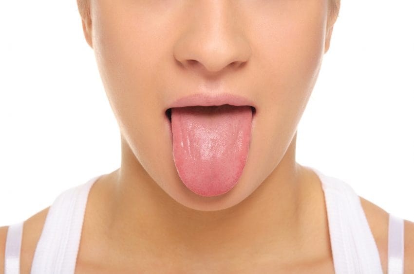 Picture of Tongue